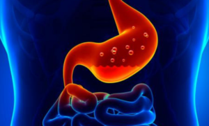 ¿Sufres de gastritis?